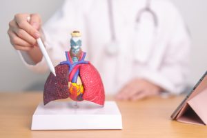 Doctor point Smoker Lung anatomy for Disease. Lung Cancer, Asthma, Chronic Obstructive Pulmonary or COPD, Bronchitis, Emphysema, Cystic Fibrosis, Bronchiectasis, Pneumonia and September world Lung day